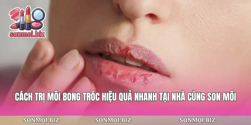 Cách Trị Môi Bong Tróc