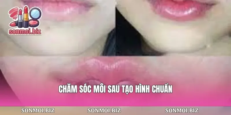 Chăm sóc môi sau tạo hình chuẩn