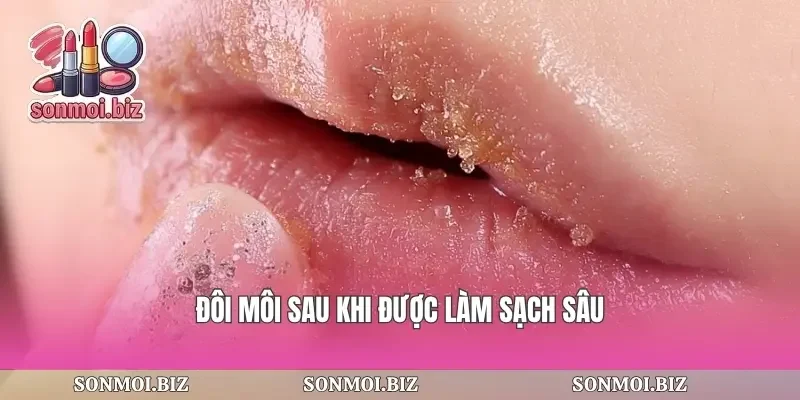 Đôi môi sau khi được làm sạch sâu