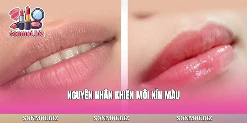 Nguyên nhân khiến môi xỉn màu