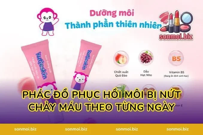 Phác Đồ Phục Hồi Môi Bị Nứt Chảy Máu Theo Từng Ngày