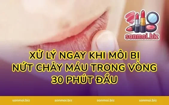 Xử Lý Ngay Khi Môi Bị Nứt Chảy Máu Trong Vòng 30 Phút Đầu